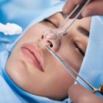 Top 5 Cosmetic Surgery Procedures in 2022