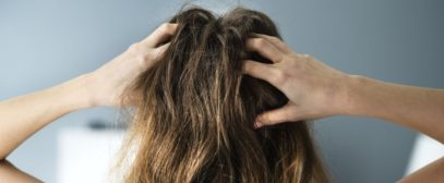 The Best Remedies for Dry Scalp in the Winter
